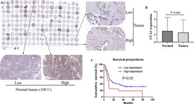 UCA1 executes an oncogenic role in pancreatic cancer by regulating miR-582-5p/BRCC3